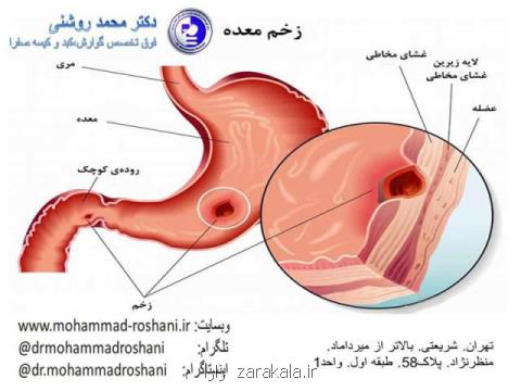 علت درد معده و عوامل تاثیرگذار روی آن