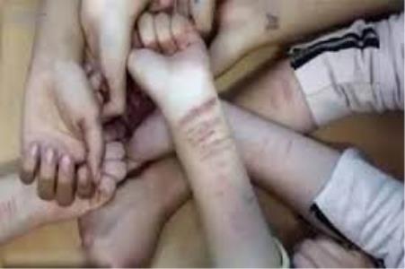 صدمه عمدی به خود یكی از رفتارهای پر خطر دانشجویان